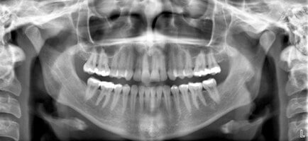 Pierwsza wizyta u ortodonty - X-Ray Dental